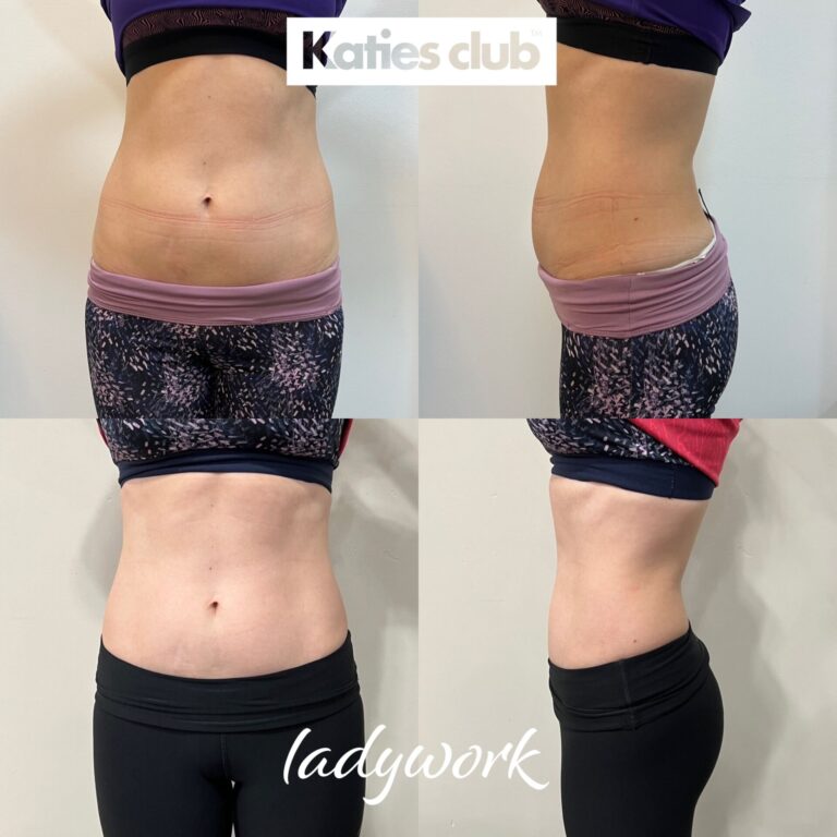 LW II - Ľubka pred a po